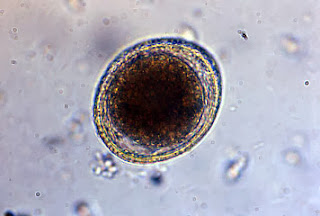 toxocara40x.jpg#s-320,216