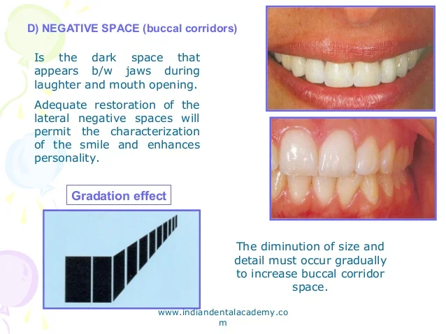 complete-denture-esthetics-cosmetic-dent