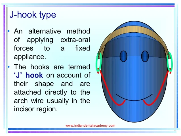 headgear-certified-fixed-orthodontic-cou