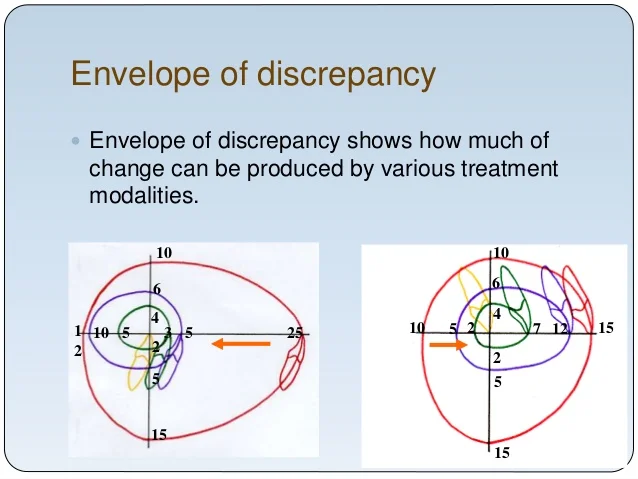 diagnosis-and-treatment-planning-in-orth