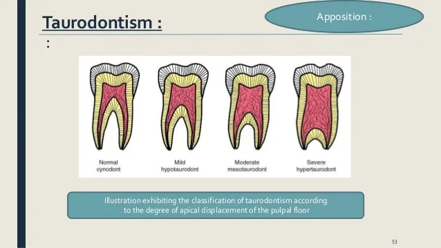 tooth-development-eruption-applied-aspec