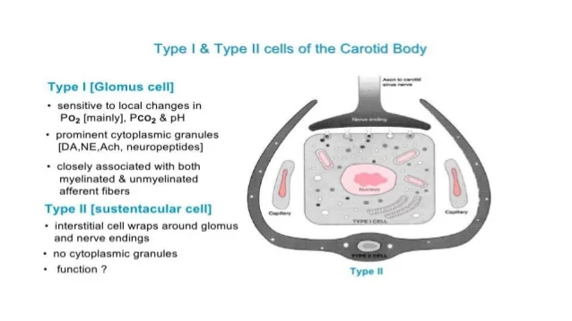 main-paragangliomas-8-638.jpg?cb=1481605513#s-638,359