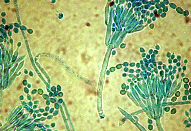 Penicillium_purpurogenum-640x440.dm.crop_0_0_640_440_EjdM.jpg#s-640,440
