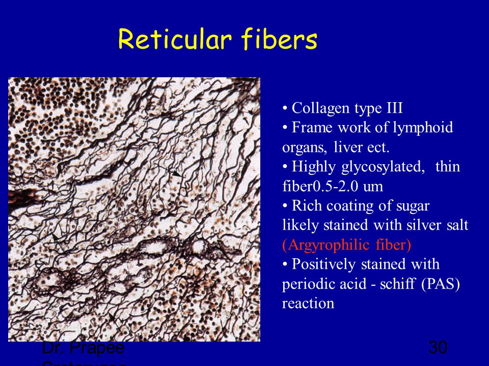 Reticular+fibers+Dr.+Prapee+Sretarugsa+Collagen+type+III.jpg