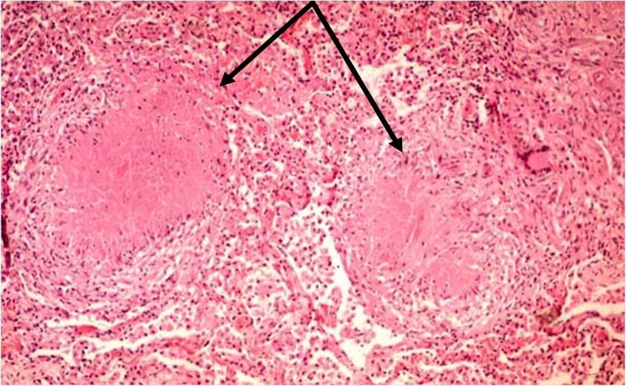 b4d629b9bc1ddb9dfb417bfae5981a0521d65565#s-914,564