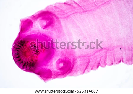 stock-photo-taenia-taeniaeformis-parasite-under-the-microscope-525314887.jpg#s-450,321