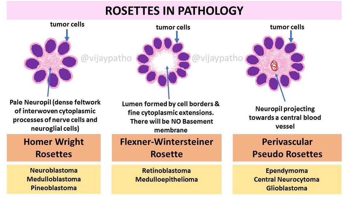 C_MB888UIAAd01L.jpg#s-1200,675