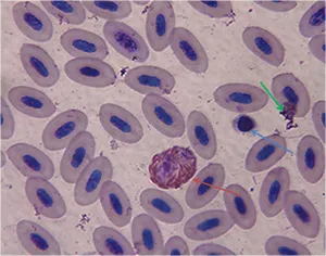 WBC-Heterophil.jpg
