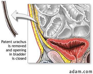 patenturachusrepair_4.jpg#s-320,256