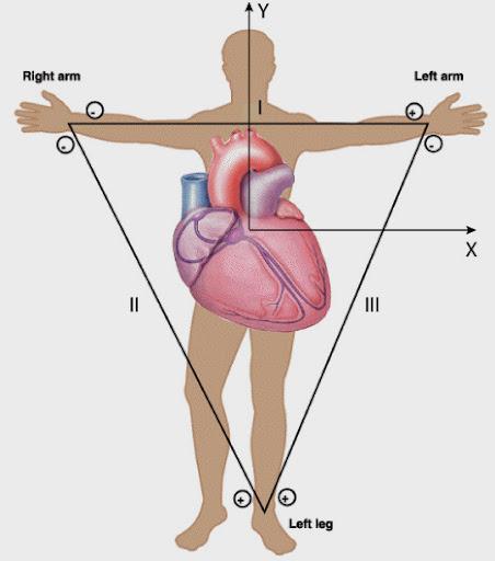 limbleads.jpg#s-452,512