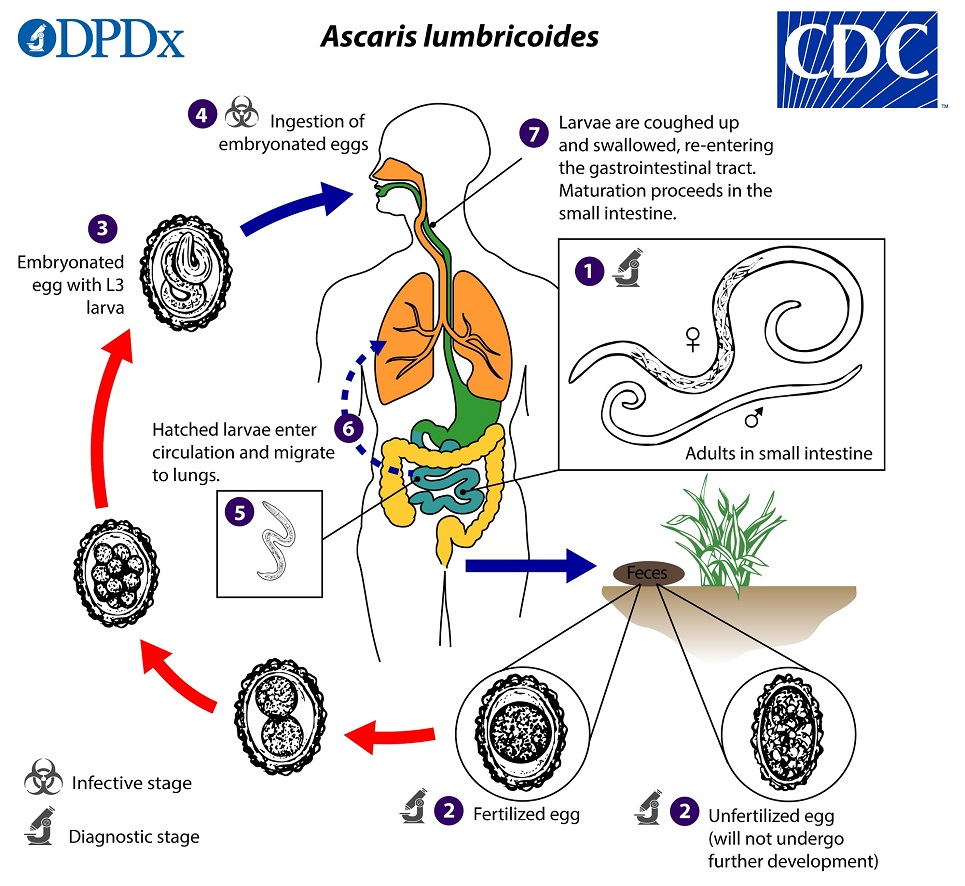 Ascariasis_LifeCycle_19.jpg