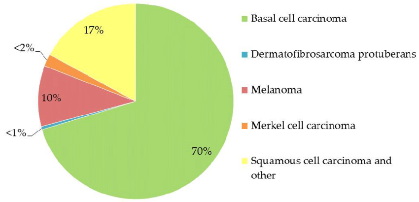 Incidence-of-different-types-of-skin-cancer.png