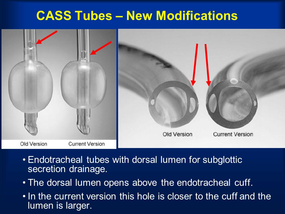 CASS+Tubes+%E2%80%93+New+Modifications.jpg