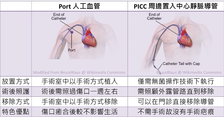 Porta%2Bvs%2BPICC.jpg