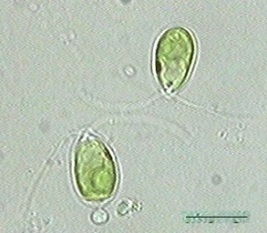 chlamydomonas12b.jpg?w=300