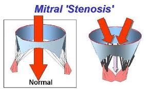 images?q=tbn:ANd9GcQLC2hIAEx_fdQ6Kqwv1DFTE4ny3cMtBSfLPA&usqp=CAU