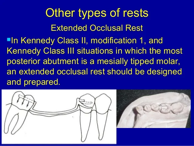 rest-and-rest-seat-58-638.jpg?cb=1457503285