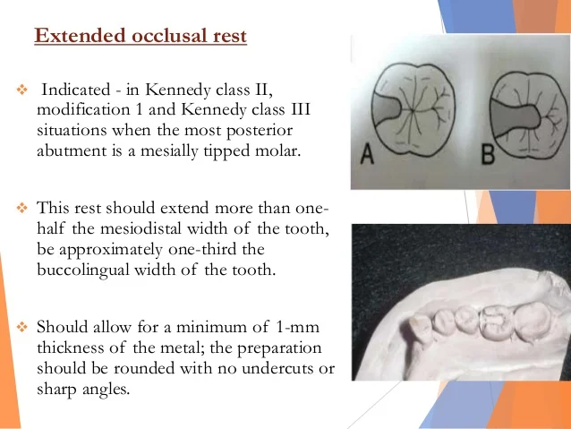 rest-and-rest-seats-31-638.jpg?cb=1531410140