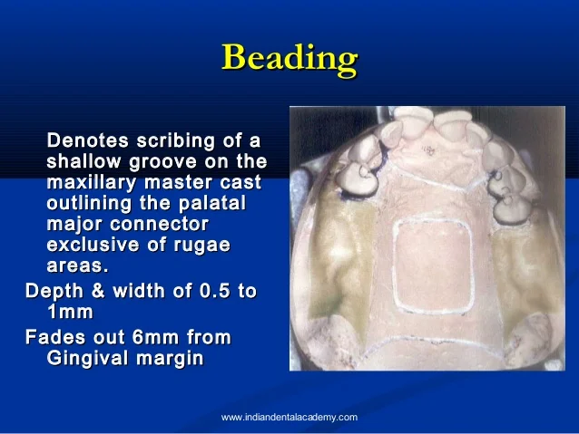 component-parts-of-cast-partial-dentures-orthodontic-courses-18-638.jpg?cb=1507722425