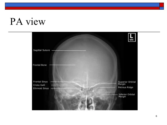 basic-anatomy-views-importance-and-positioning-interpretation-skull-radiography-6-638.jpg?cb=1422083416