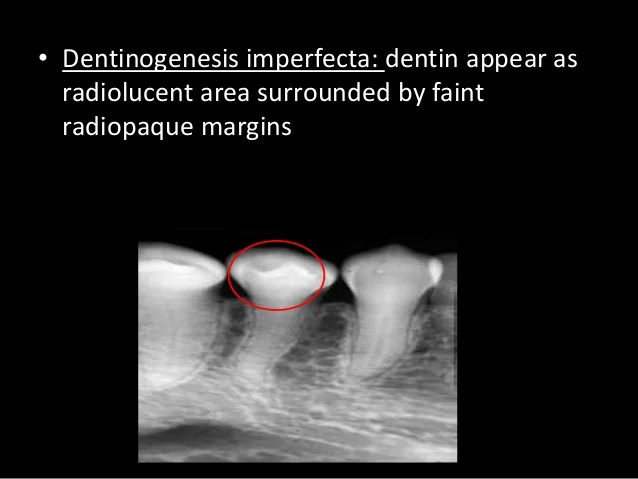 radiographic-interpretation-29-638.jpg?cb=1408285815