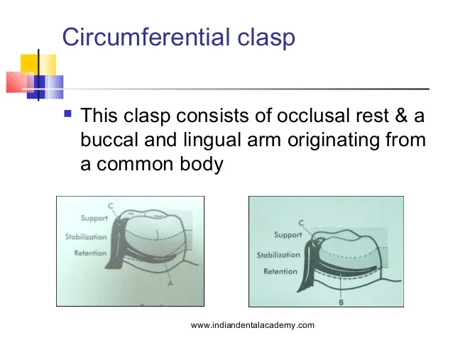 retainers-in-rpd-labial-orthodontics-25-638.jpg?cb=1507107083