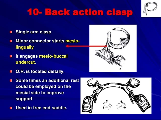 b-retention-of-removable-partial-dentures-29-638.jpg?cb=1574631821