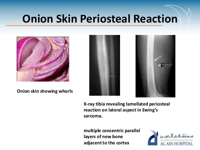 food-signs-in-radiology-pp-ta-28-638.jpg?cb=1471861464