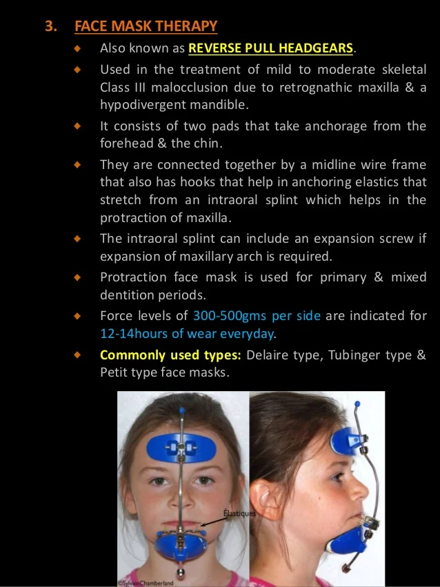 class-iii-malocclusion-15-638.jpg?cb=1471883244