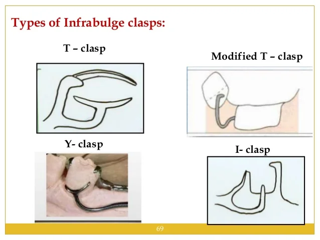 direct-retainers-68-638.jpg?cb=1531410108