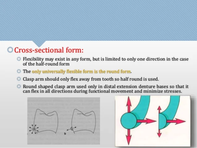 direct-retainers-in-removable-partial-dentures-31-638.jpg?cb=1412770105