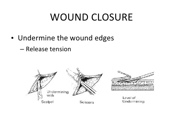 woundcare-37-728.jpg?cb=1259584953