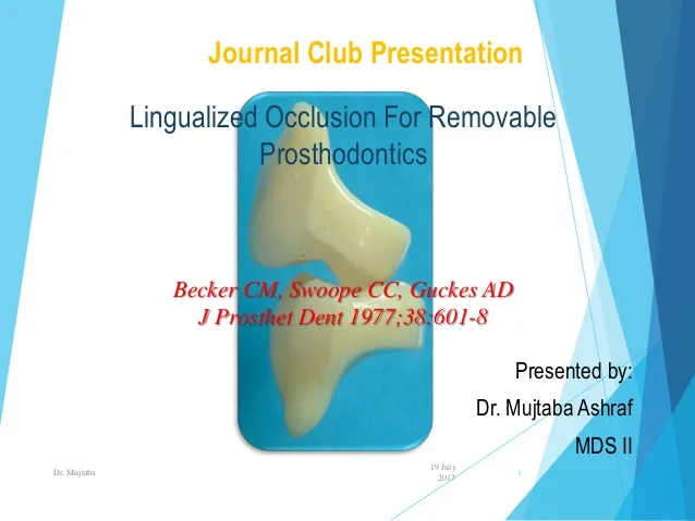 lingualized-occlusion-in-rdp-1-638.jpg?cb=1500444267