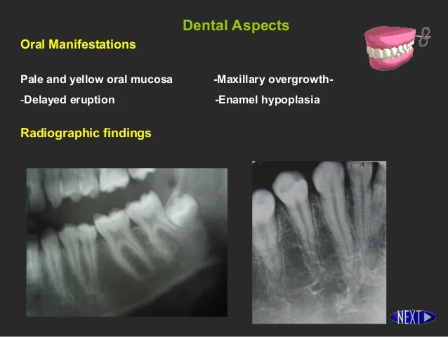 dental-management-of-medically-compromized-patients-4-638.jpg?cb=1390299732