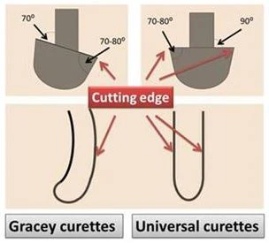gracey_and_universal_curette_pic_for_dis.jpg?v=1594084895