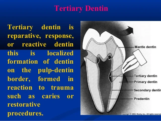 dentine-39-638.jpg?cb=1511005030