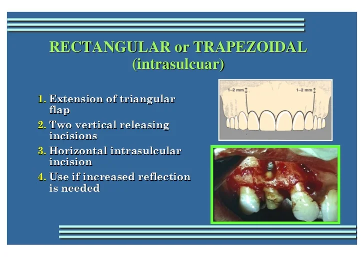endodontic-surgery-16-728.jpg?cb=1347612501