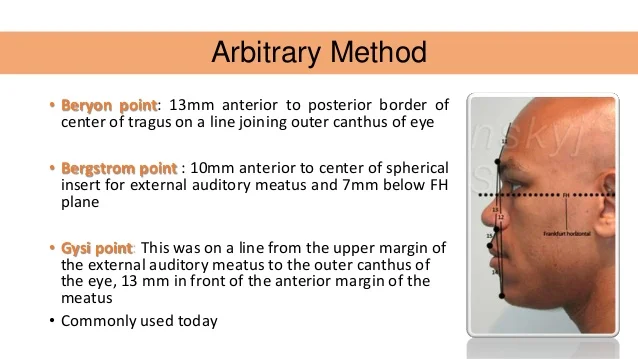 hinge-axis-31-638.jpg?cb=1394726244