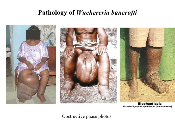 filarial-nematodes-17-728.jpg?cb=1269477466