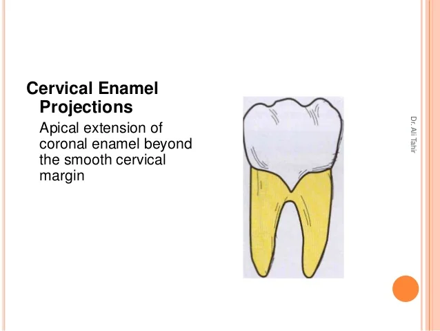 developmental-oro-facial-disturbances-part-1-28-638.jpg?cb=1355180065