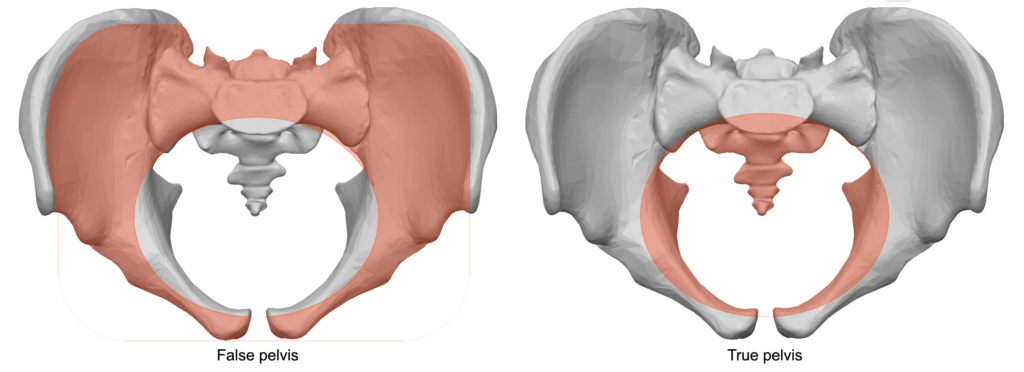 Pelvis_true_vs_false-1024x372.png