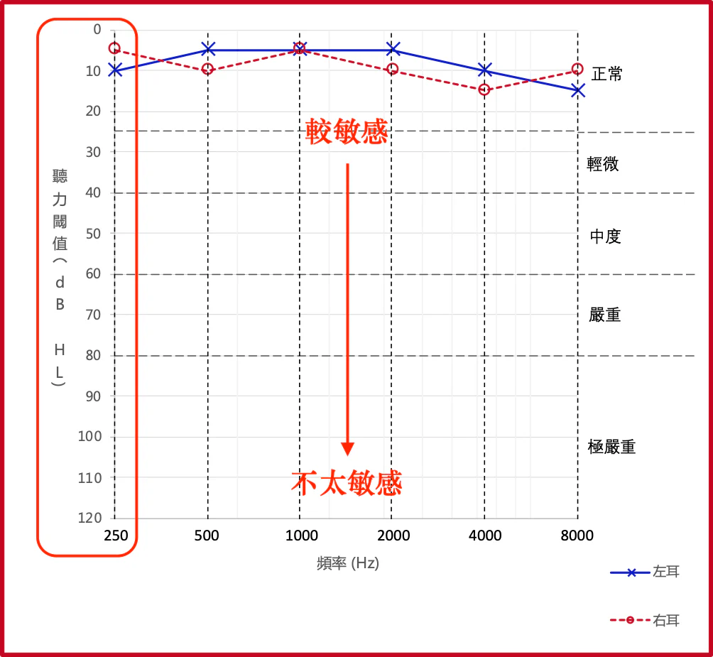框住垂直軸的聽力圖