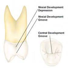 Root and Canal Morphology of Maxillary First Premolars in a Saudi Population