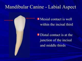 Maxillary and Mandibular Canines