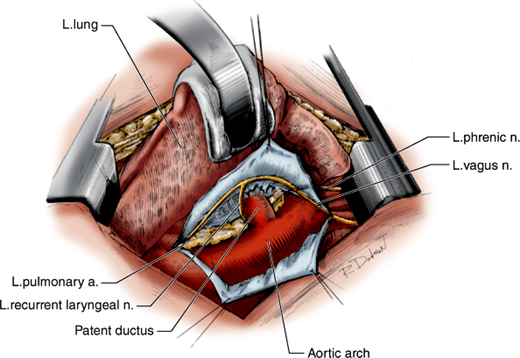 m_Hop002_Fig_63-01.png?zoom=1.25&w=960