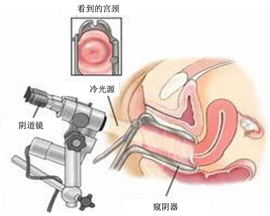 zIYBAF6YaeGAEKJUAAdk6wms1-c774.png?_ms_=2601