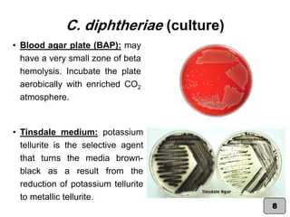 Corynebacterium spp. & Listeria monocytogenes (Practical Medical Micr&hellip;