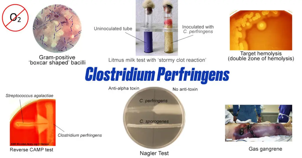 Clostridium-perfringens-common-features-1024x536.jpg