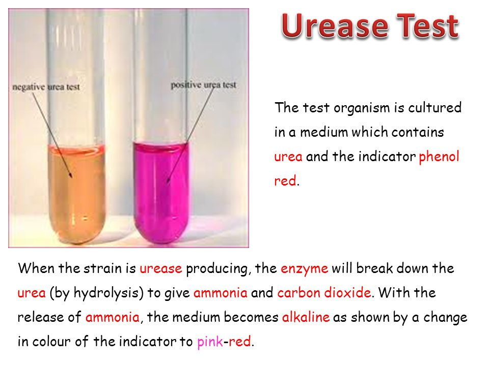 urease-test.jpg