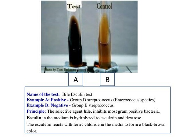 Bile-Esculin-Test.jpg